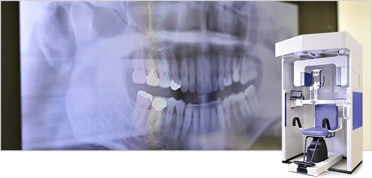 歯科用CTを用いた診査・診断